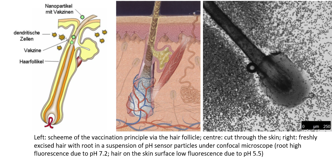Topical vaccination: Vaccine particles for vaccination via the skin